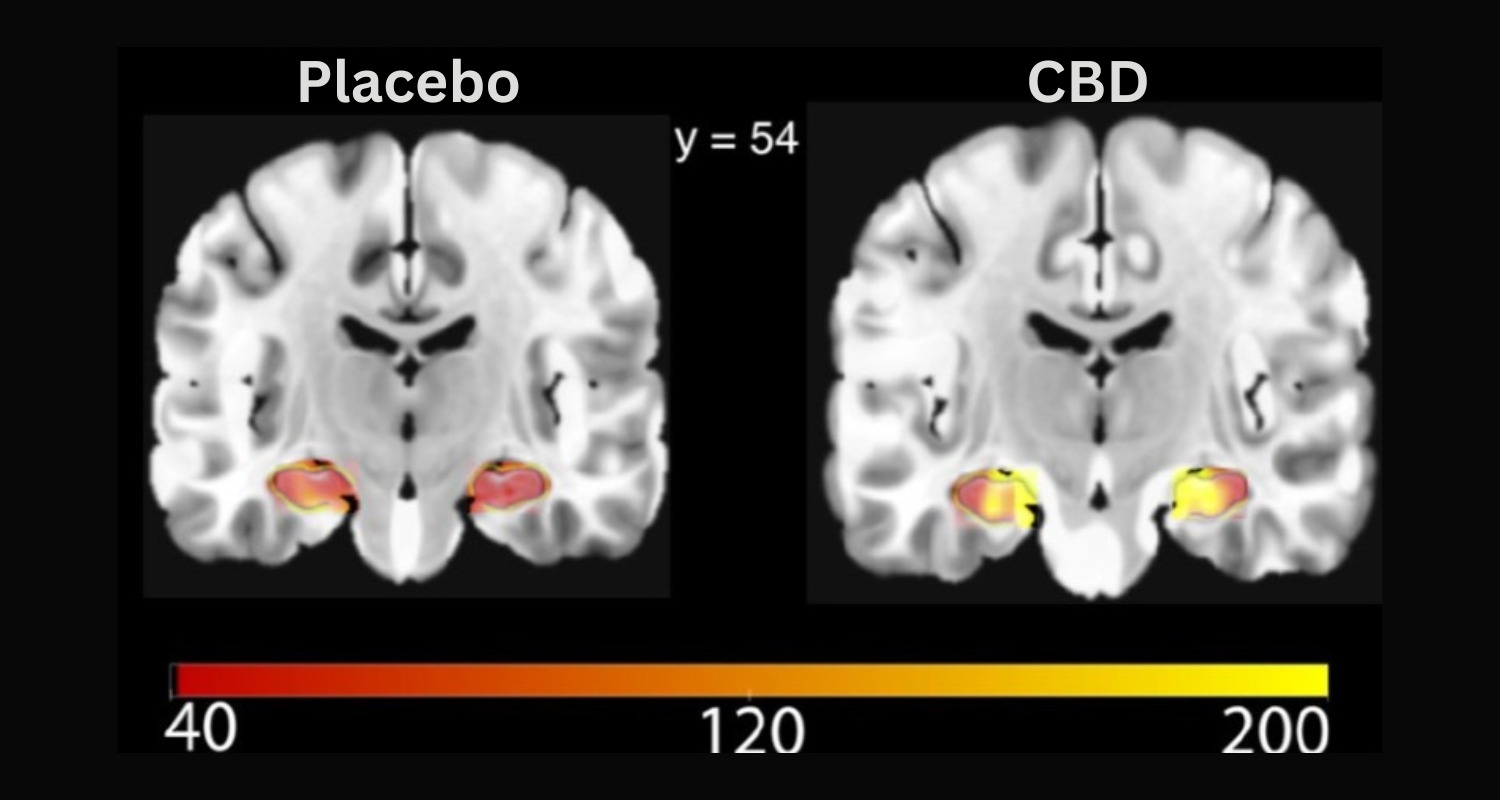 CBD for brain